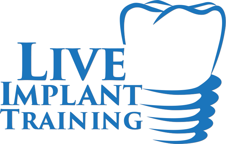 Live Implants US
